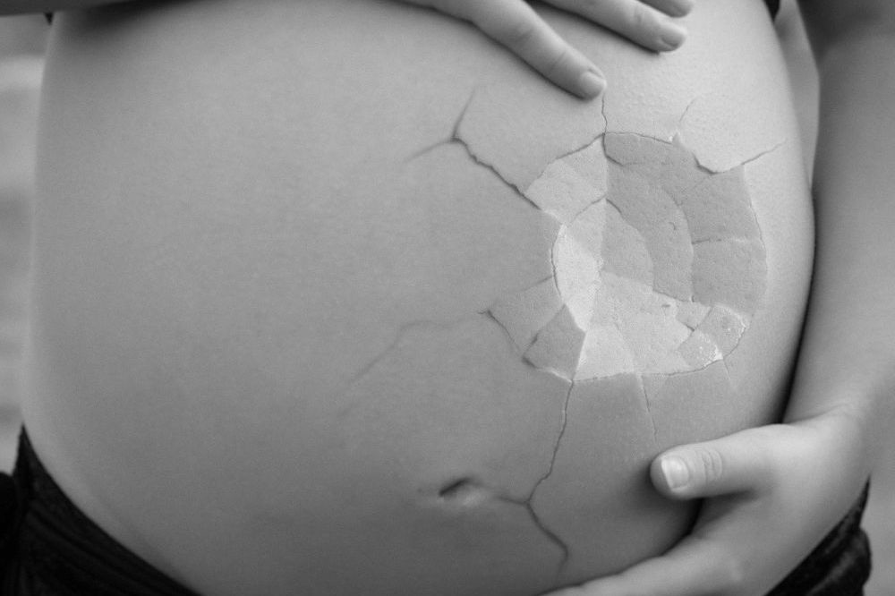 Tips voor een mooie huid tijdens de zwangerschap